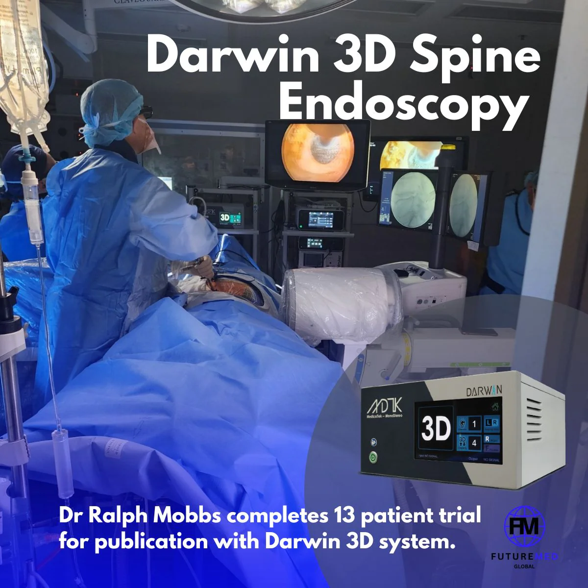Darwin 3D Spine Endoscopy - 13 Patient trial complete for publication.